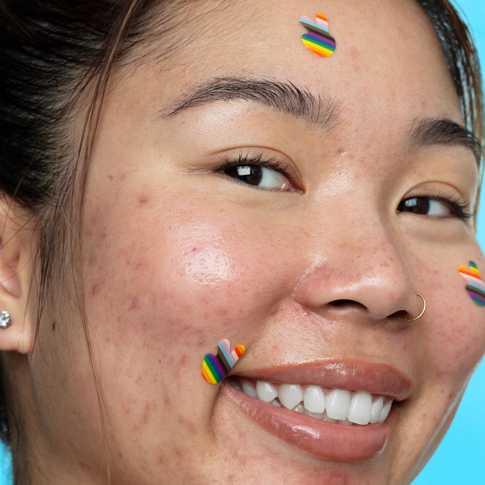 PRIDE ACNE HEALING DOTS (PARCHES ANTI-ACNÉ)